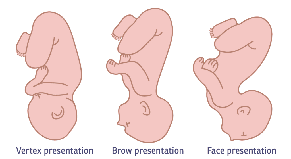 Optimal Baby Positioning During Pregnancy: 5 Simple & Effective Tips